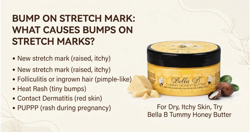 Bump on Stretch Mark
