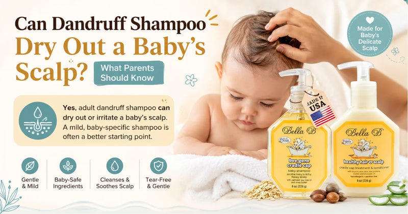 Can Dandruff Shampoo Dry Out a Baby’s Scalp What Parents Should Know