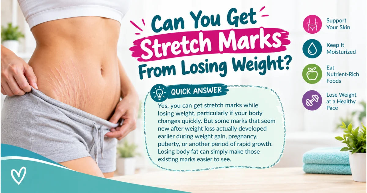 Can You Get Stretch Marks From Losing Weight?