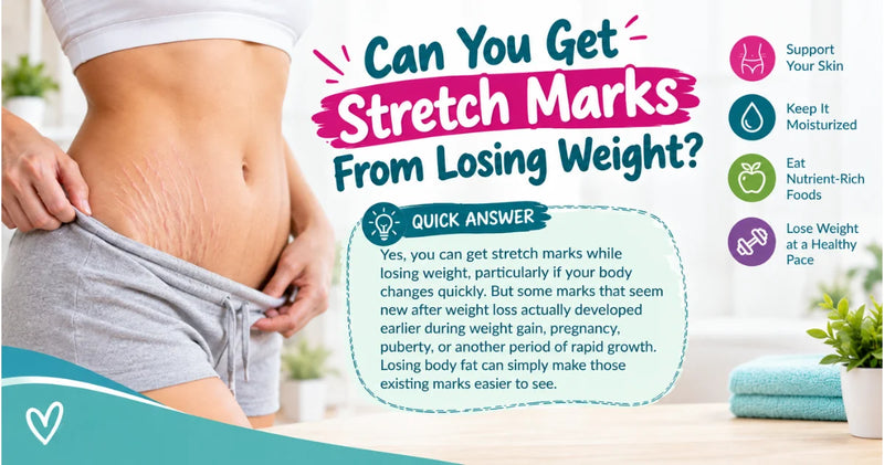 Can You Get Stretch Marks From Losing Weight