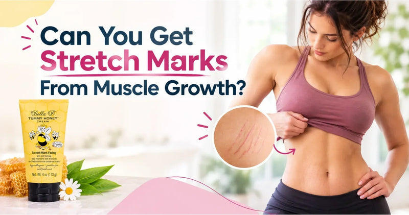 Can You Get Stretch Marks From Muscle Growth