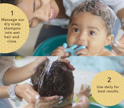 Bee Gone Cradle Cap Baby Shampoo 8oz